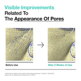 BHA 2% Gentle Exfoliating Toner